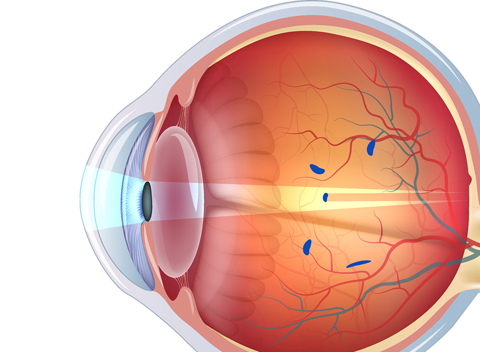 Flashing light in left eye 2025